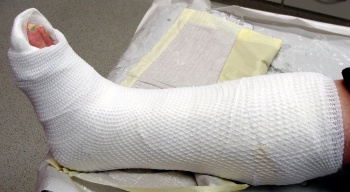 Gips